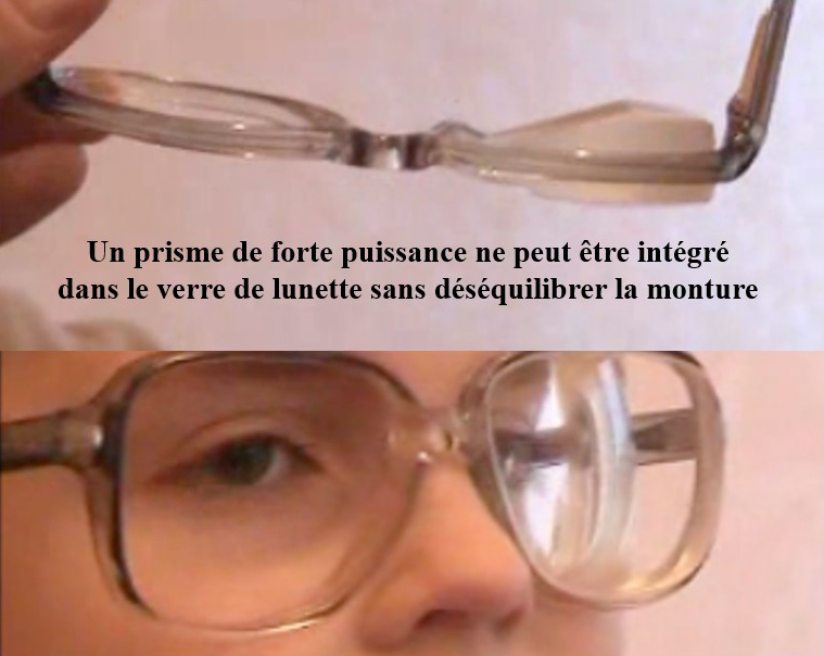 un prisme de forte puissance ne peut être intégré dans le verre de lunette sans déséquilibrer la monture